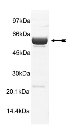 Eurofins DiscoverX DAPK1 Protein, Active 250 &mu;g | Buy Online | Eurofins DiscoverX | Fisher Scientific